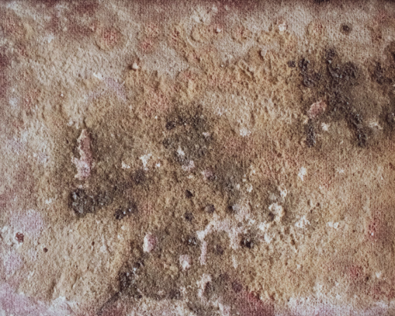 Mold growth on a wall.